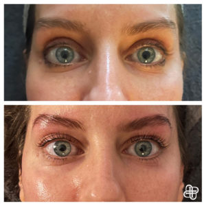 Lexington KY, Before & After of Eyebrows & Lashes Treatment